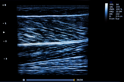 Musculoskeletal Ultrasound